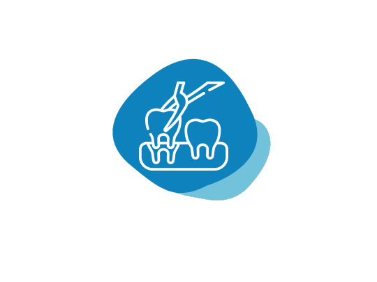 Wisdom Tooth Extraction Santa Clarita CA