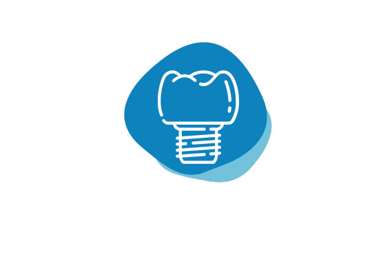 Dental Implants Santa Clarita CA | Sierra Dental