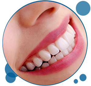 Porcelain Veneers Santa Clarita CA