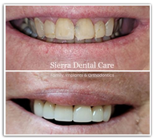 Dentist Near Santa Clarita CA