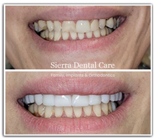 Dentist in Santa Clarita CA | Orthodontics | Braces