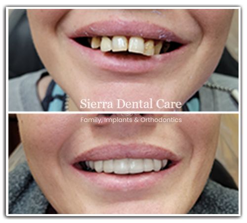 Dentist in Santa Clarita CA | Cosmetic Dentistry